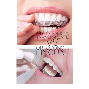 ortodoncia_estetica