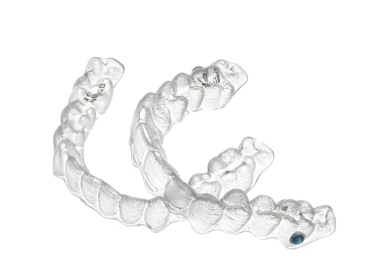 Uso de ortodoncia transparente invisalign