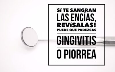 ¿Sufres sangrado de encías? Puede que padezcas gingivitis o piorrea