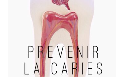 Consejos para prevenir la caries