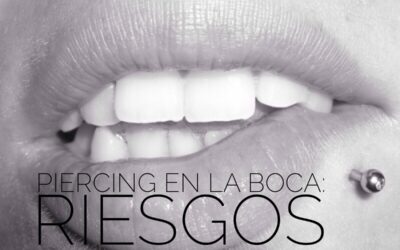 Piercing en la boca: los riesgos para los dientes