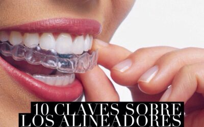 10 claves sobre los alineadores Invisalign