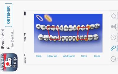 ¿Qué aplicaciones dentales existen? Nuestra selección de App dentales
