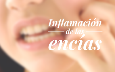 ¿Por qué tengo dolor de encías?