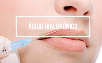Rejuvenecimiento facial con ácido hialurónico, ¿qué es?