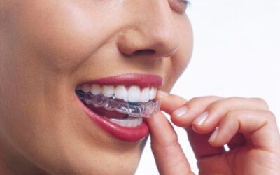 ¿El tiempo de duración de la ortodoncia depende del tipo de ortodoncia?