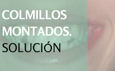 Ortodoncia: solución para los colmillos montados