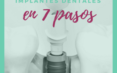 Implantes dentales en 7 pasos