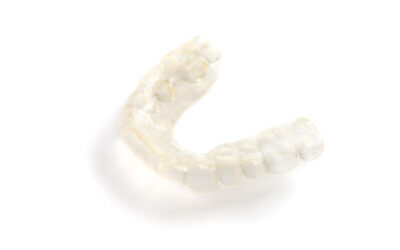 Férula de descarga: tratamiento para el bruxismo