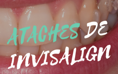 Ataches de Invisalign: ¿Qué son y para qué sirven?