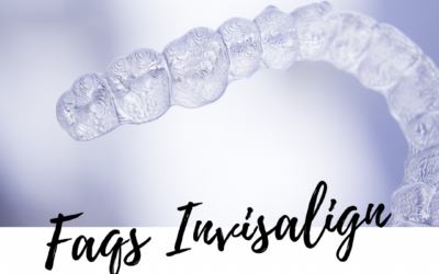Preguntas frecuentes alineadores transparentes Invisalign: primera visita