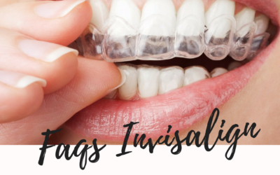 Preguntas frecuentes alineadores transparentes Invisalign: Instrucciones de uso
