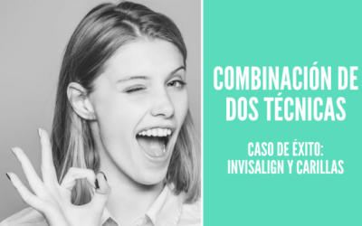 Ortodoncia y carillas ¡Combinamos las dos!