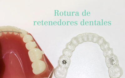 ¡Se me han roto los retenedores dentales! ¿Y ahora qué?