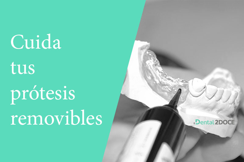 Mantenimiento de prótesis dentales removibles