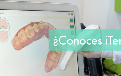 Dental 2DOCE siempre con la última tecnología: Escaner Intraoral iTero