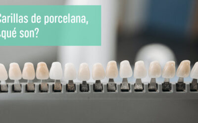Carillas de Porcelana: Ventajas y Desventajas