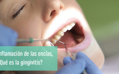 Gingivitis: ¿encías inflamadas y sangrantes?
