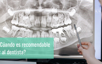 Revisión dental anual: ¿Cuándo es recomendable ir al dentista?