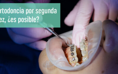 Ortodoncia por segunda vez: ¿es posible retomar este tratamiento?