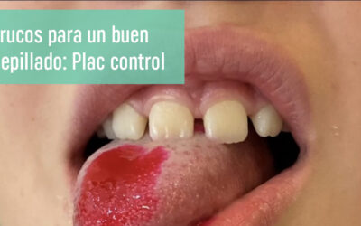 Plac control en niños, ¿cómo funciona?