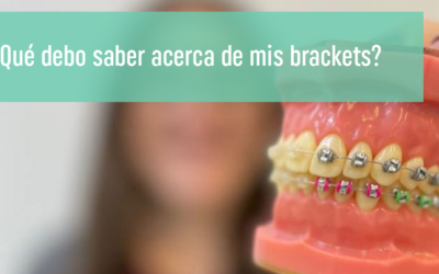 ¿Qué debo saber acerca de mis brackets?