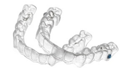 invisalign